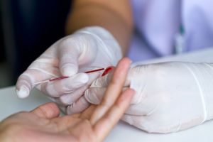 Як проводиться і що показують результати клінічного аналізу крові?