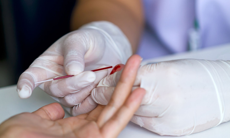 Як проводиться і що показують результати клінічного аналізу крові?