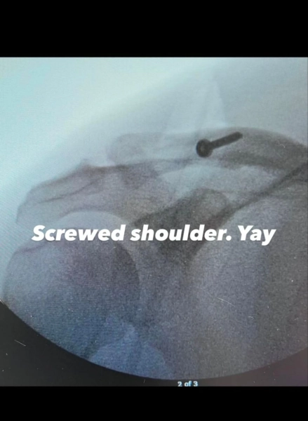 c6aa09e5e17f339080b1f03b30567b7f - Ченнінг Татум прооперований на плечі, фото з лікарні